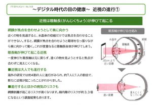 2024.10　プチ　近視のサムネイル